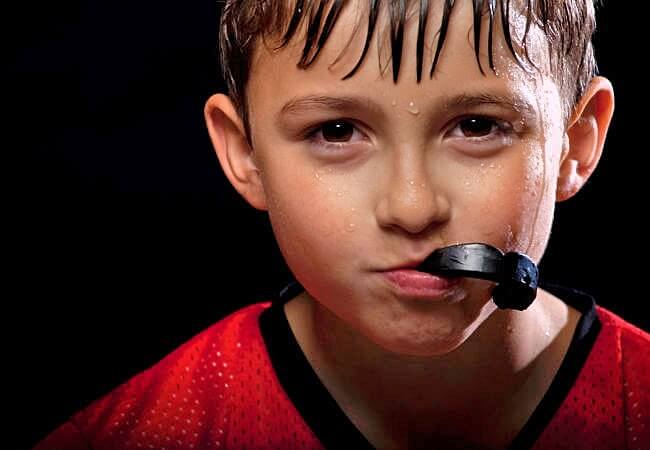 Mouthguard
