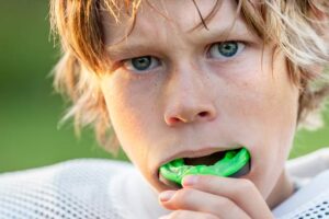 7 facts about your sports mouth guard grand rapids dentist